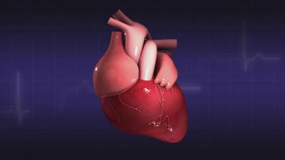 Aorta proglašena za zaseban ljudski organ: Evo šta to znači za pacijente