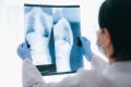 Zdravlje kičme i metode lečenja: Spinalna hirurgija u Turskoj
