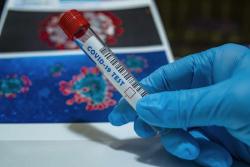 51 medicinar obolelo od korona virusa u somborskoj bolnici