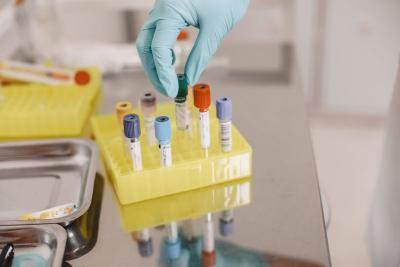 Kako prepoznati manjak progesterona - važnog hormona za funkcionisanje tela