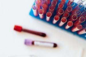 Osobe s ovom krvnom grupom imaju veći rizik od opasne bolesti jetre