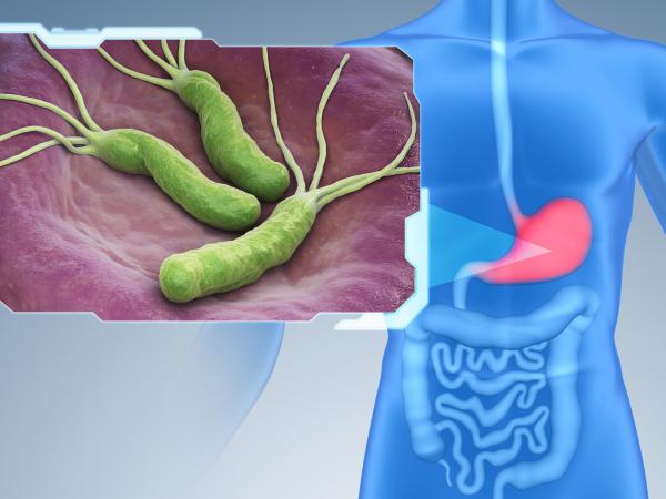 Heliko bakterija: Kako se prenosi i koji su simptomi