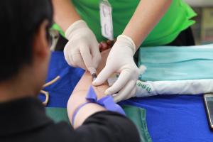 Divertikuloza se javlja kod većine ljudi sa godinama: Šta je to zapravo, koji su simptomi i kako se leči